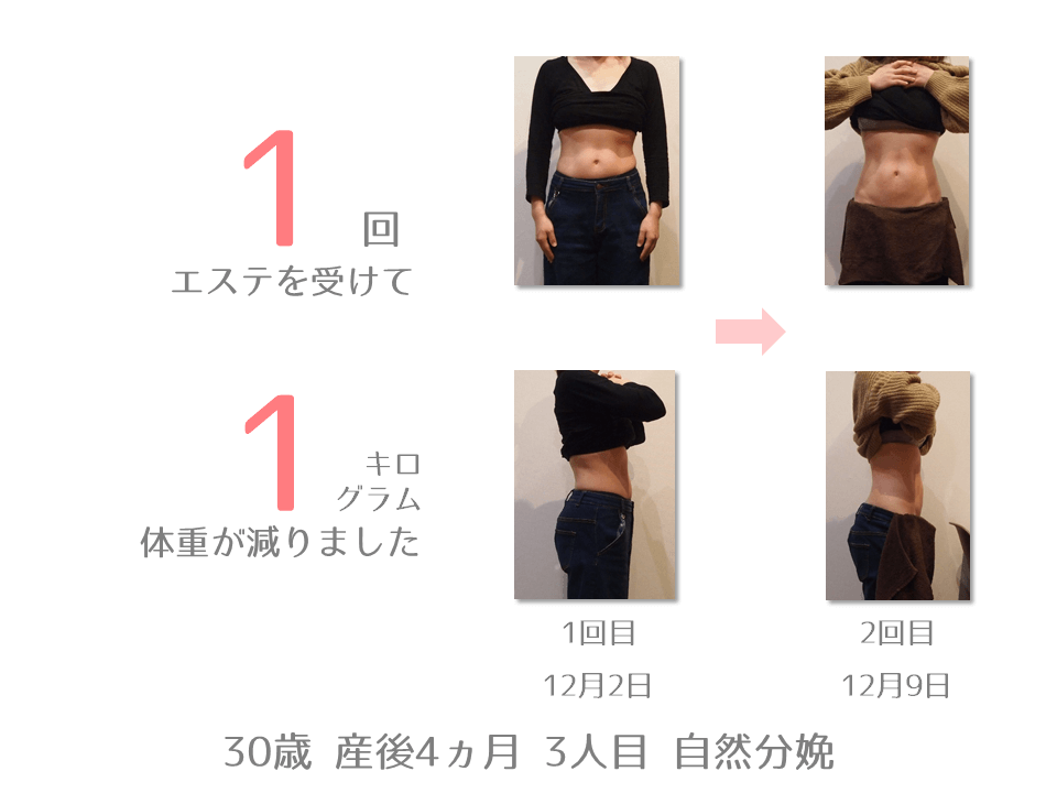 子連れで行けるエステ 子連れで行ける京都 長岡京市の産後骨盤矯正 みやもと鍼灸整骨院