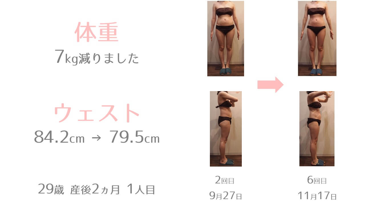 産後エステ29歳女性
