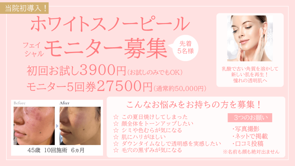 ホワイトスノーピール。フェイシャルモニター5名様募集！
初回お試し3900円。モニター価格5回券27500円。（通常50000円）